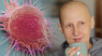 Científicos identifican la proteína clave que alimenta el cáncer.