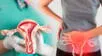 Prevención del cáncer de cuello uterino.