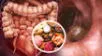 La falta de una proteína clave, posible causa del cáncer de colon.