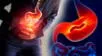 La infección silenciosa puede causar gastritis, úlceras y aumentar el riesgo de cáncer gástric.