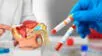 Esta es la prueba casera que detecta el cáncer de próstata en 15 minutos.