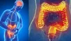 Descubre todo sobre esta enfermedad inflamatoria intestinal.