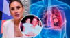 Descubre qué es el cáncer de pulmón, sus causas, síntomas y tratamientos.