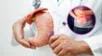 Dieta preventiva para cáncer gástrico y esofágico: qué incluir y qué evitar según especialistas