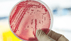 El nuevo gen que salta entre bacterias de diferentes tipos para otorgarles inmunidad.