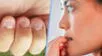 ¿Por qué algunas personas se muerden las uñas? Esto dice la psicología