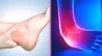 Cómo fortalecer tendones y ligamentos para evitar lesiones.