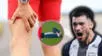 ¿Qué es un desgarro en el bíceps femoral, cómo se trata y cuánto tarda la recuperación? Lesión que deja fuera a Alan Cantero del Alianza Lima vs. Sporting Cristal