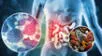 El alimento que podría disminuir el riesgo de cáncer colorrectal.