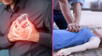 Insuficiencia cardíaca e infarto fulminante: diferencias, síntomas y causas según especialistas
