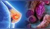 Cáscara del camote morado podría ayudar a prevenir el cáncer de mama.