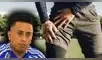 Lesión miosfacial en el recto anterior: causas, síntomas y tratamiento, dolencia que afectó a Christian Cueva y motivó su retorno a Perú