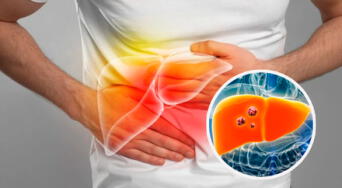 Cáncer de hígado: tratamientos efectivos y hábitos saludables para la prevención