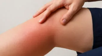 ¿Pasas mucho tiempo sentado? Piernas hinchadas, con calor y otras señales que no debes ignorar