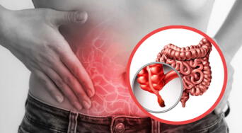 Apendicitis: qué es, cuáles son sus síntomas, causas y cómo se trata esta urgencia médica.