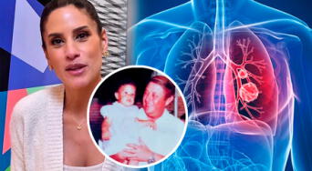 Cáncer de pulmón: todo sobre la enfermedad que afectó al padre de María Pía Copello