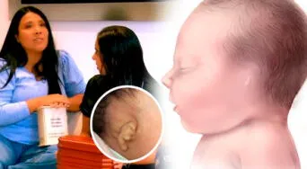 ¿Qué es la microtia unilateral? La condición auditiva que enfrenta la hija de Tula Rodríguez