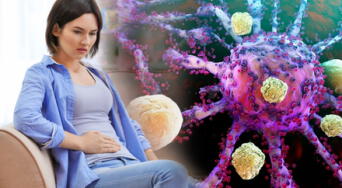 Alerta médica: el cáncer silencioso que avanza entre jóvenes y preocupa a expertos