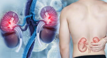 ¡No los ignores! Estos síntomas pueden indicar riesgo de cáncer de riñón, según expertos