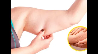 ¡Adiós celulitis! El alimento natural que combate la retención de líquidos eficazmente