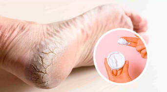 ¿Tienes talones agrietados? Esta crema para pies promete resultados en solo dos aplicaciones