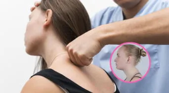 Joroba de búfalo: qué es, por qué aparece y qué ejercicios ayudan a corregirla, según fisioterapeuta