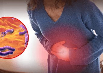 Alerta médica: la bacteria silenciosa que podría causar millones de casos de cáncer de estómago, según expertos