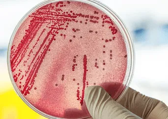 Alerta sanitaria: científicos detectan gen que hace a las bacterias inmunes a los antibióticos