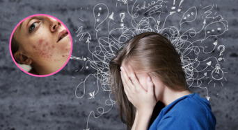 Piel y estrés: ¿cómo se refleja el desequilibrio emocional en tu rostro y cuerpo?