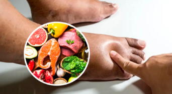 Los alimentos recomendados para combatir la retención de líquidos, según expertos