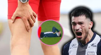 ¿Qué es un desgarro en el bíceps femoral, cómo se trata y cuánto tarda la recuperación? Lesión que deja fuera a Alan Cantero del Alianza Lima vs. Sporting Cristal