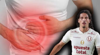 ¿Qué es la apendicitis, cuáles son sus síntomas y cómo se trata? Afección que alejó a Williams Riveros de Universitario de Deportes por 25 días