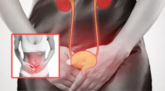 Así es una infección urinaria: lo que debes saber para prevenirla a tiempo