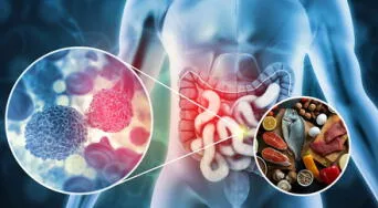 ¡No lo ignores! Este es el alimento que podría disminuir el riesgo de cáncer colorrectal, según un especialista