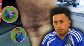 Rotura fibrilar o desgarro muscular: causas, cómo tratar y cuánto dura la lesión que mantuvo alejado a Christian Cueva de las filas del Emelec