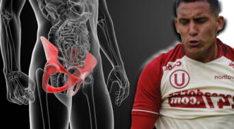 ¿Qué es la pubalgia? Causas, síntomas y tratamiento de la afección que mantiene a Alex Valera fuera de la Selección Peruana