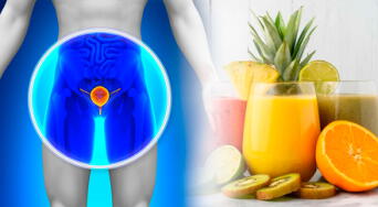 Cáncer de próstata: esta es la bebida natural que podría frenar su avance, según una experta