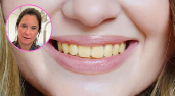 ¿Por qué se ponen amarillos los dientes? Causas y tratamientos recomendados por ortodoncista