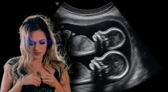 Lesly Águila, de Corazón Serrano, responde a conmovedora pregunta sobre su gemela: el impacto de la muerte de un gemelo en el otro, según expertos