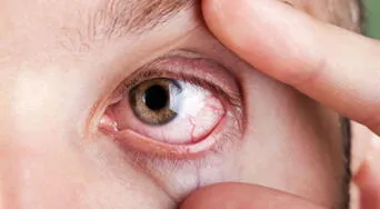 Esta es la actividad física que ayuda a prevenir enfermedades oculares, respaldada por la ciencia
