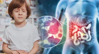 El cáncer colorrectal temprano podría tener origen en la infancia, revela estudio