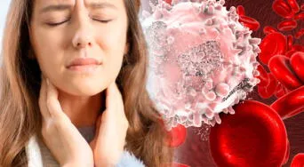 ¿Fatiga, sudoración o ganglios inflamados? Podrían ser señales de este tipo de cáncer a la sangre