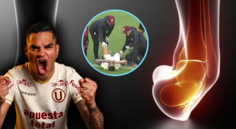 5 pasos para una recuperación más rápida del esguince de tobillo, lesión que sufrió Anderson Santamaría, jugador de Universitario de Deportes