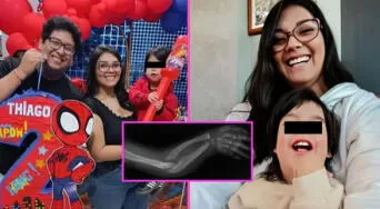 Niño peruano enfrenta extraña enfermedad que solo 10 personas en el mundo la padecen: ¿qué es la mesomelia-sinostosis y cuáles son sus causas?