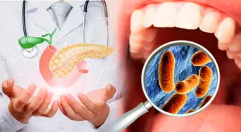 Bacterias en la boca podrían influir en el desarrollo del cáncer de páncreas, según expertos