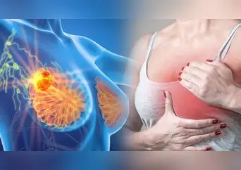 Médicos ignoran síntomas de madre joven, pero era cáncer de mama en etapa 4: cómo identificar signos y actuar rápido