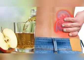 Bebidas para cuidar los riñones: opciones naturales y efectivas Bebidas para cuidar los riñones: opciones naturales y efectivas