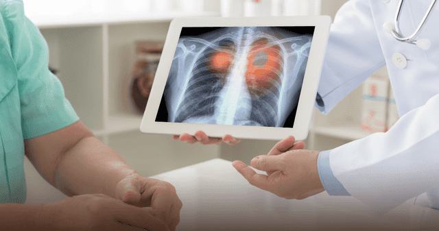 Científicos descubrieron que la inflamación provocada por infecciones respiratorias despierta células tumorales, lo que podría explicar el repunte de metástasis tras la pandemia. Científicos descubrieron que la inflamación provocada por infecciones respiratorias despierta células tumorales, lo que podría explicar el repunte de metástasis tras la pandemia.