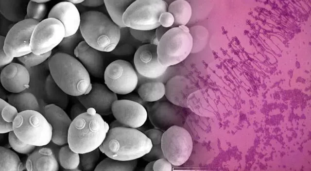 Imagen microscópica de la Saccharomyces cerevisiae. Foto: composición GLR/difusión Imagen microscópica de la Saccharomyces cerevisiae. Foto: composición GLR/difusión