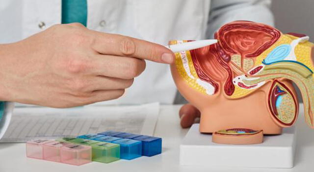 Los tratamientos contra los problemas de próstata deben ser supervisados por especialistas. Foto: Portafolio Los tratamientos contra los problemas de próstata deben ser supervisados por especialistas. Foto: Portafolio